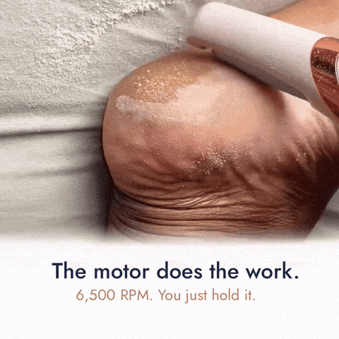 Close-up video showing Velara Grace electric foot file 
removing dry heel callus with 6500 RPM motor — 
white powder particles visible as device works 
on mature heel skin. Zero pressure needed.