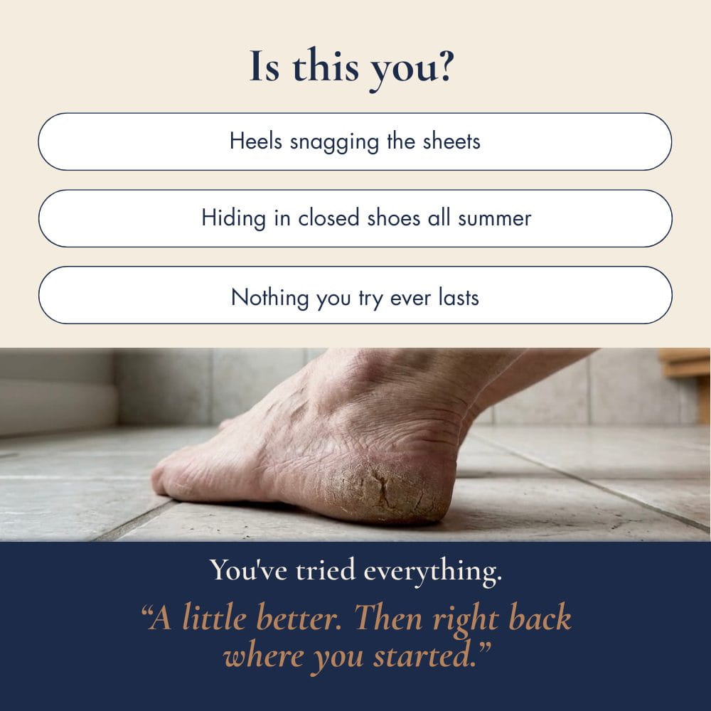 Close up of a mature woman's dry, cracked heel on a bathroom tile, illustrating common menopause foot care frustrations like heels snagging on bed sheets and thick callus build-up.